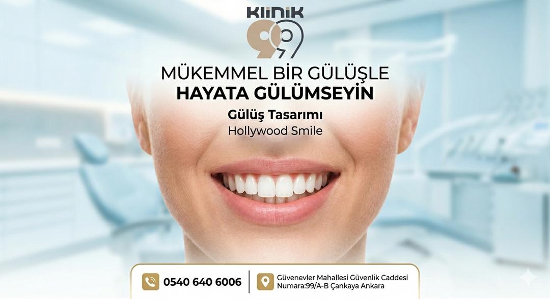 Gülüş tasarımı, gummy smile