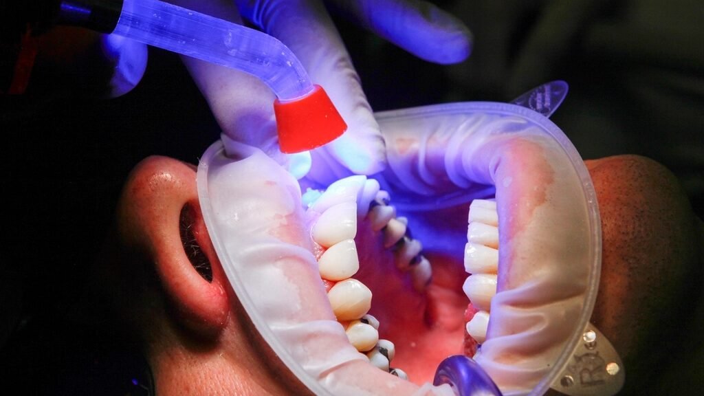 Dental Filling Prices 2026: Composite, Amalgam and Inlay Fees