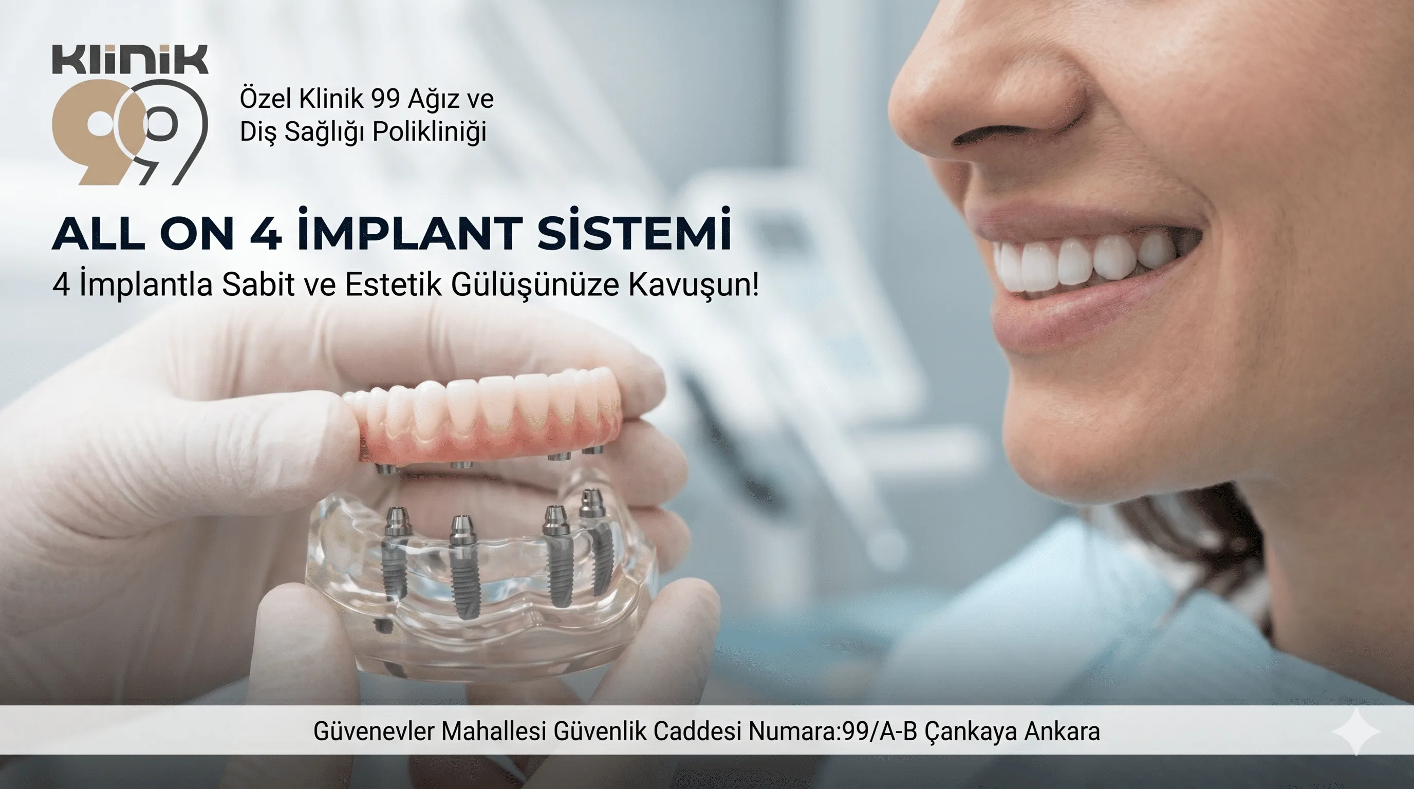 All-on-4 Implant Treatment